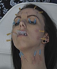 Medical Needle Pain