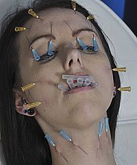 Medical Needle Pain