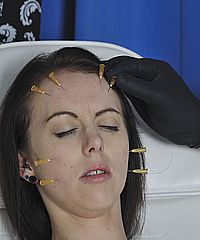 Needle Tortured Patient